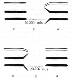 Esquema de las transiciones silábicas